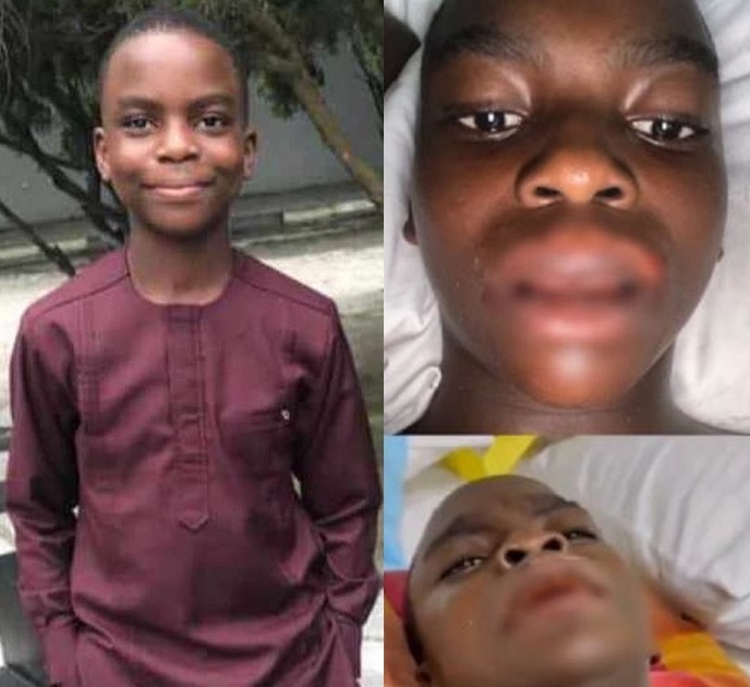 Lagos Govt clears all five students and staff arrested over Sylvester Oromoni’s death, says autopsy ruled out murder and no harmful substance was found in his body 4 Lagos Govt clears