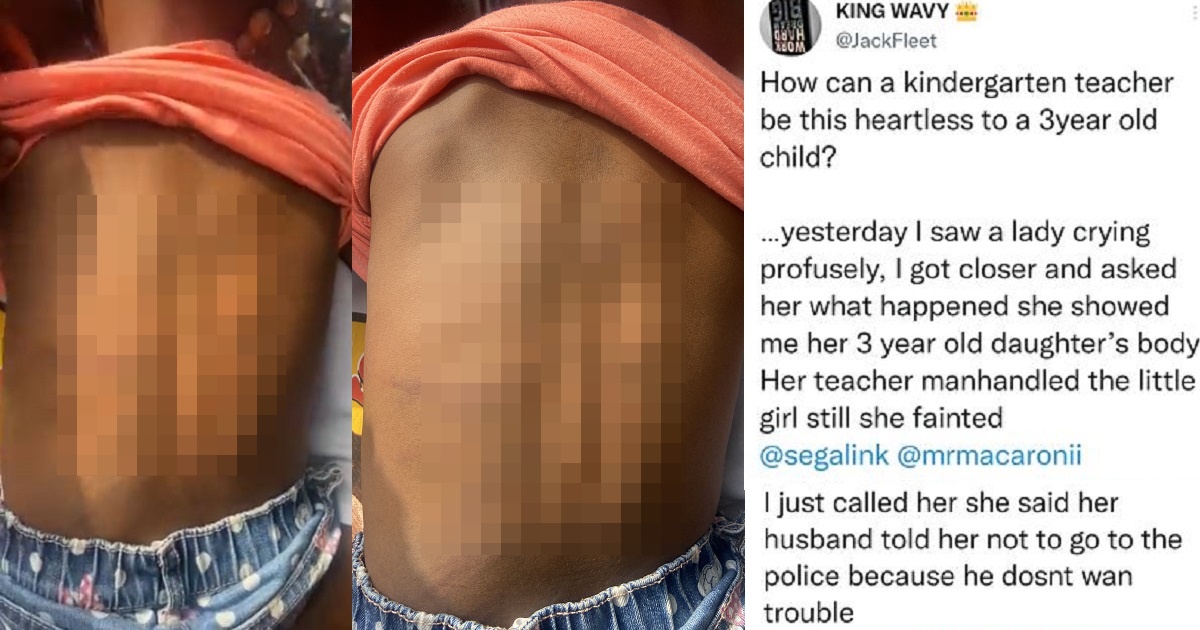 3-year-old girl reportedly brutalized by her kindergarten teacher; parents refuse to press charges (video)
