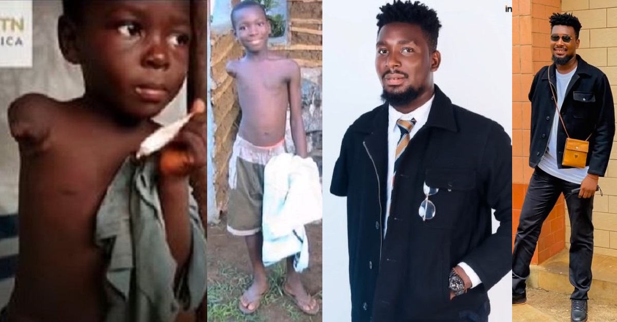 Differently-abled man shares amazing transformation (video)