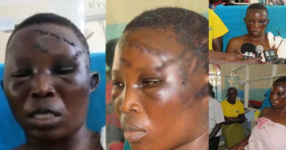 HIV positive man hacks wife with machete for denying him s3x