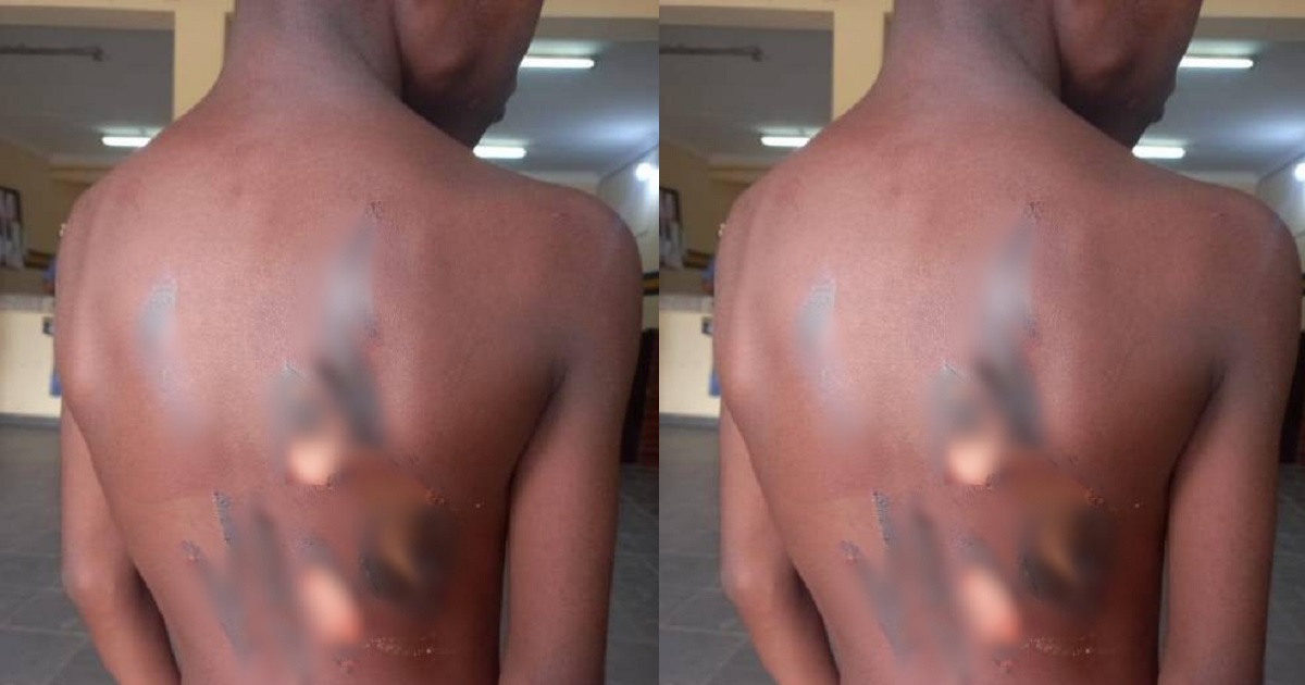 Lagos resident flees after allegedly brutalizing 10-year-old girl with hot knife and pepper