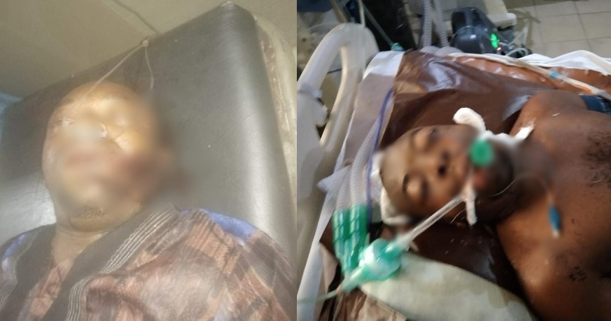 Yet-to-be-identified man found on the road after being involved in a ghastly accident in Rivers state (photos)