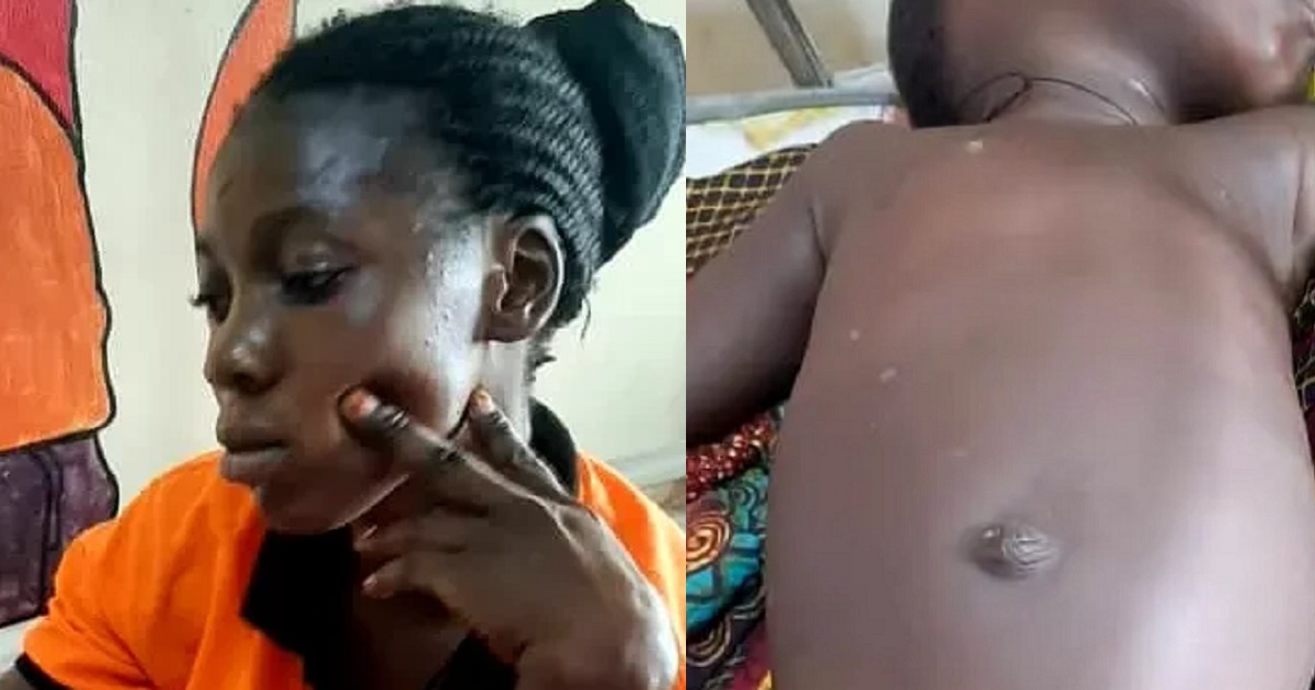 2-year-old girl battles for life after being shot in private part by Fulani herdsmen in Benue
