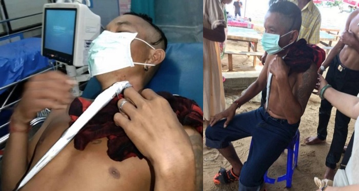 Screaming tourist dragged from river after he was impaled in the neck by a needlefish (Photos)
