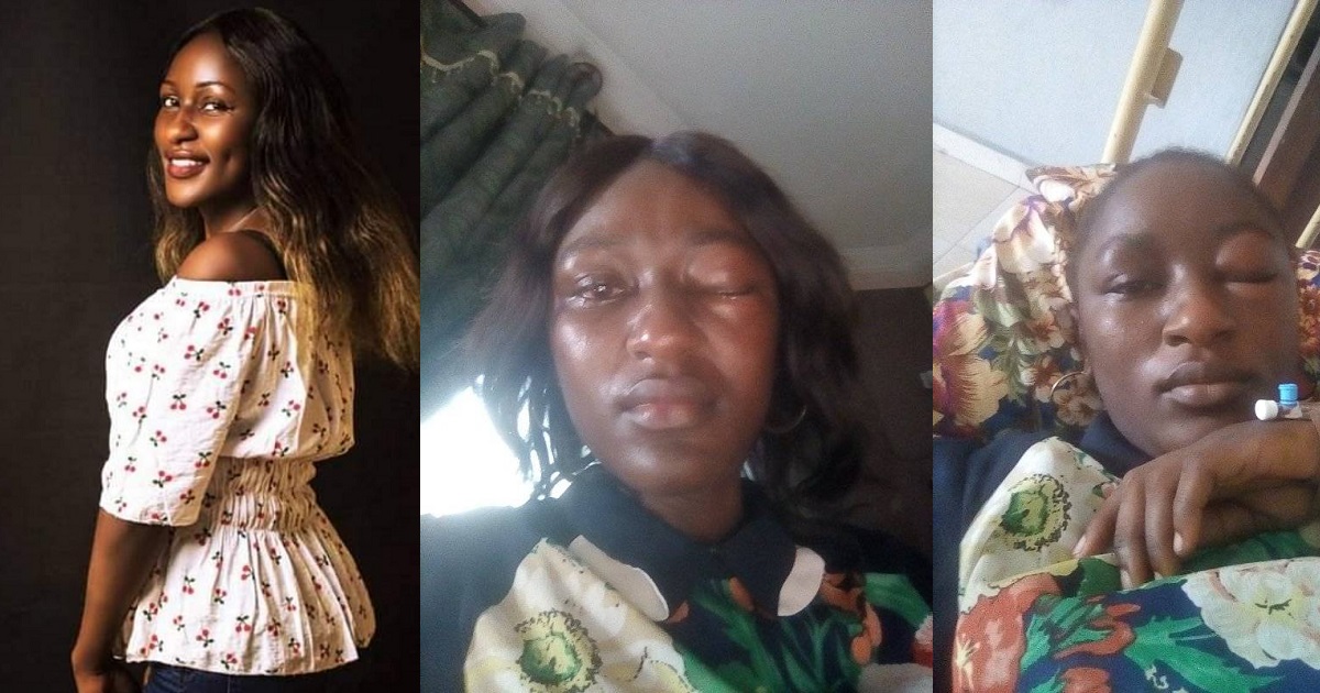 “I shall not die before my time” – Nigerian woman cries out after husband allegedly battered her