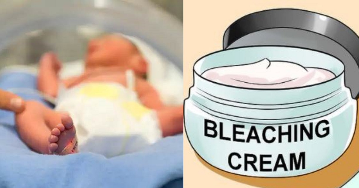 Baby develops chronic kidney disease after her mom bleached her skin