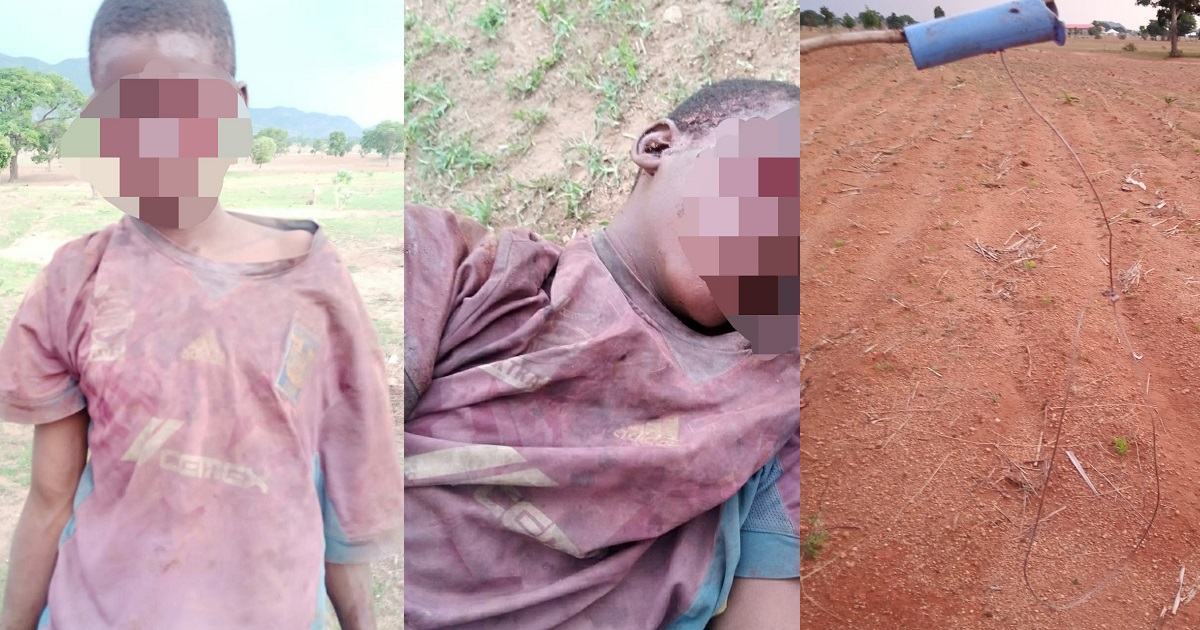 16-year old boy’s eyes plucked out by his ’employer’ in Bauchi (photos)