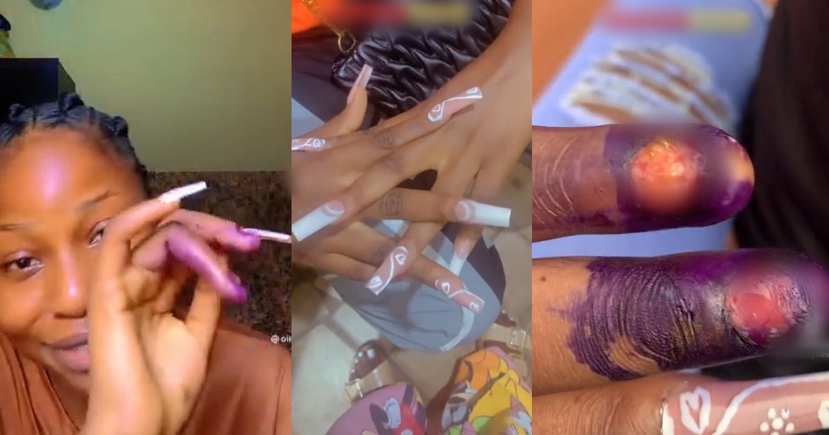 Lady who sustained painful injury after making her beautiful nails, explains what happened (Video)