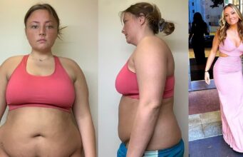 21-year-old lady shares