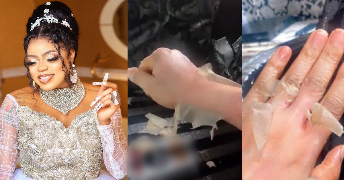 “Until you vanish” – Reactions as Bobrisky peels skin’ for young, glowing skin