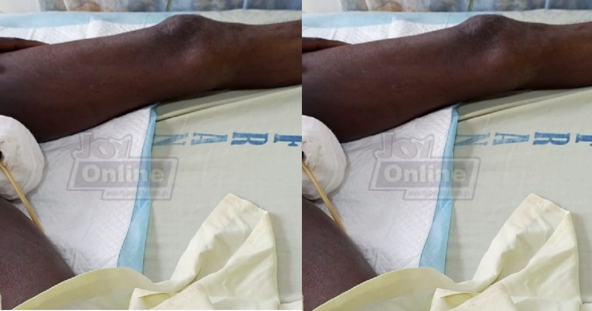 Man accidentally cuts off his ‘SOMETHING’ while dreaming about cutting meat