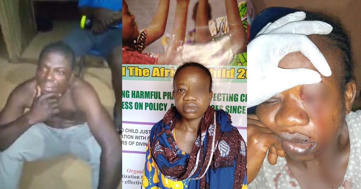 Nigerian woman narrates how her husband allegedly bit her eye while trying to stop him from beating their 13-year-old daughter with a machete