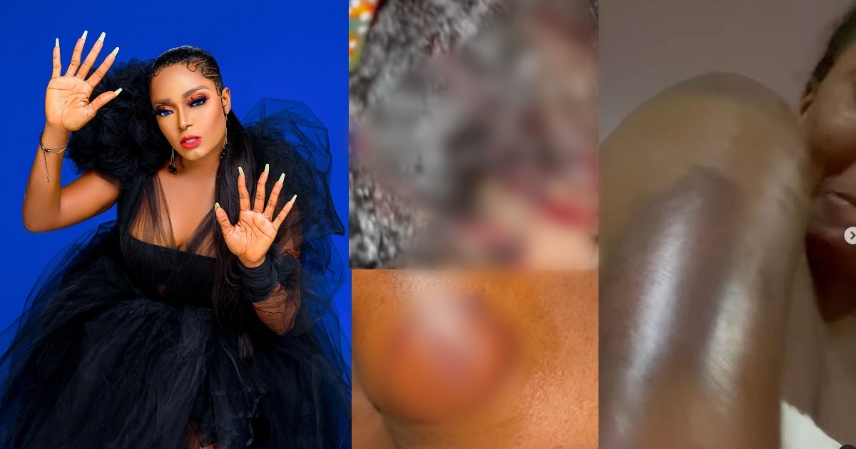 Actress Helen Duru left with a fractured skull and covered in blood after EFCC operatives allegedly stormed her residence (Video)
