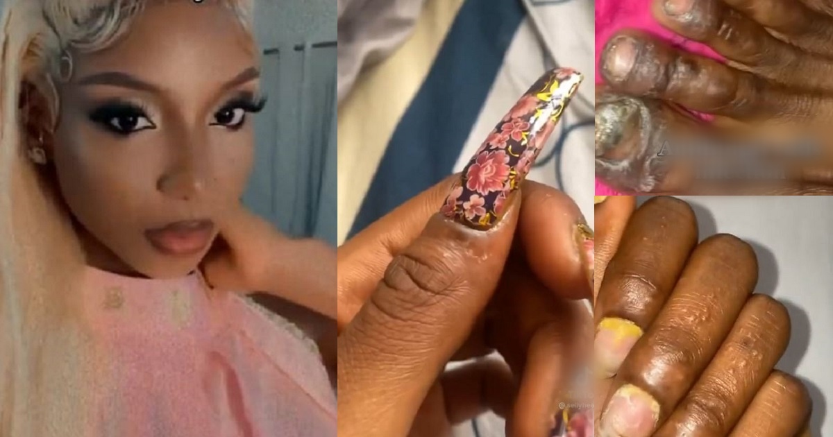 Lady lucky to be alive after artificial nails got her nails badly infected (Video)