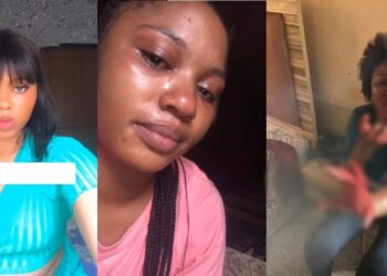 Nigerian lady who sufferred domestic abuse at the hands of her Lover shares what she looked like before she met him. (VIDEO