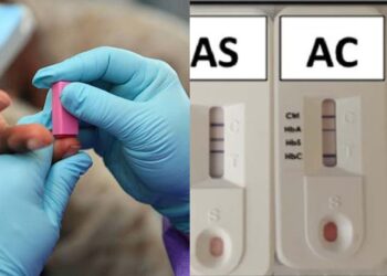 “God gave me as a birthday gift” – Nigerian lady narrates how her genotype miraculously changed from AS to AA