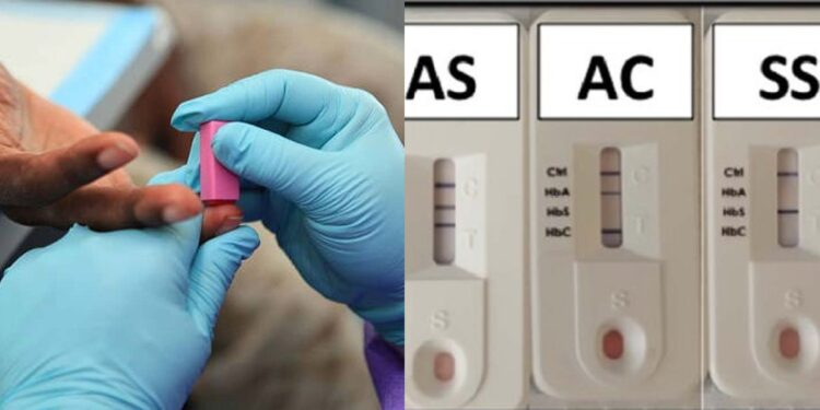 “God gave me as a birthday gift” – Nigerian lady narrates how her genotype miraculously changed from AS to AA