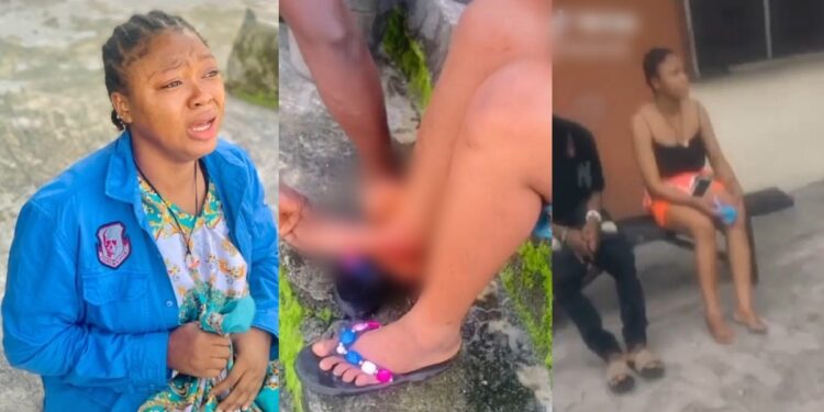 “Stay away from fake friends”  — Lady warns as she recounts how she was poisoned by a female friend (video)