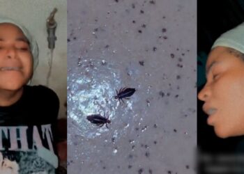 Nigerian lady breaks down in tears at the sight of lice harvested from her hair (Video)