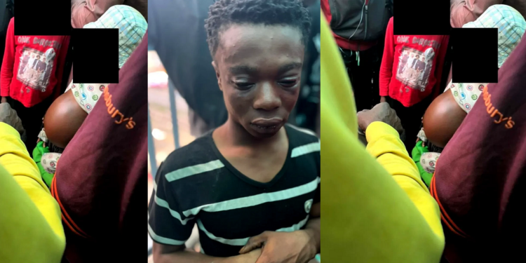 My oga gives them drugs that cause swelling – A man in Lagos admits to using children with fake stomach tumors to beg for alms.