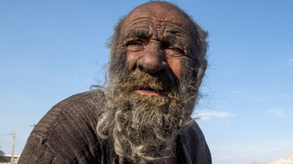 World's dirtiest man dies