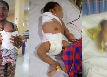 2-month-old baby’s arm amputated after angry father allegedly battered him for disturbing his sleep