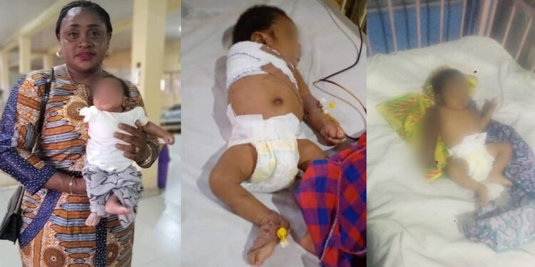 2-month-old baby’s arm amputated after angry father allegedly battered him for disturbing his sleep