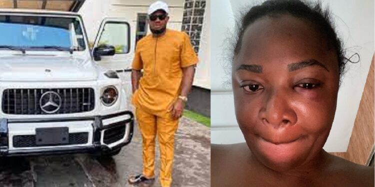 Bimbo, wife of popular businessman, IVD, escapes being incinerated to death at their home in Lagos.
