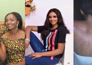 “I was beaten like a common criminal” – Nigerian woman accuses her estranged husband of threatening to kill her after she left him due to alleged domestic violence