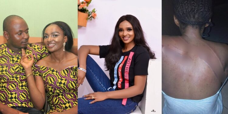 “I was beaten like a common criminal” – Nigerian woman accuses her estranged husband of threatening to kill her after she left him due to alleged domestic violence