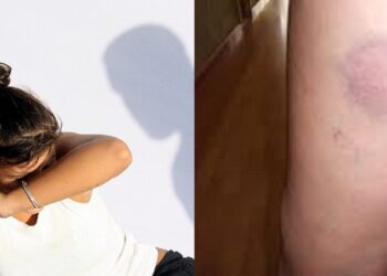 “My sister went back to her abusive boyfriend and this time he didn’t spare her” – Engineer laments.