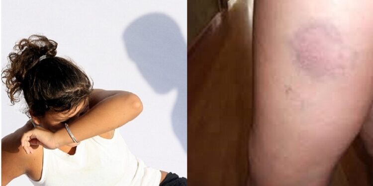 “My sister went back to her abusive boyfriend and this time he didn’t spare her” – Engineer laments.