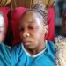 “This is the way I look now” – South African lady shows disfigured face after her baby daddy attacked her with bottle