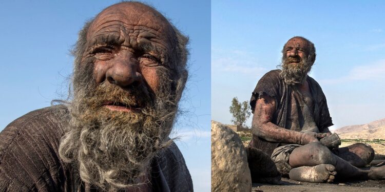 World's dirtiest man dies