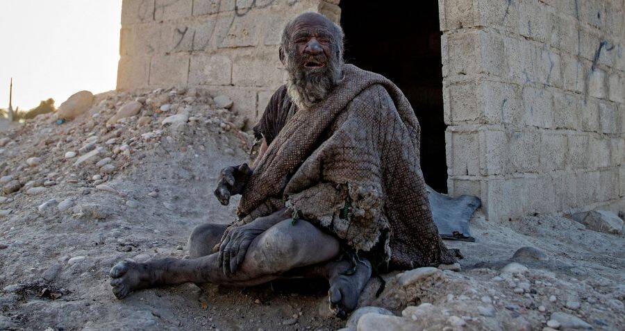 World's dirtiest man dies