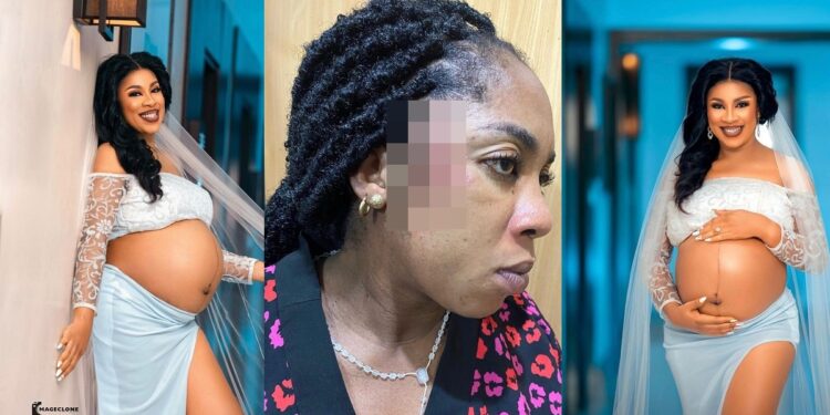 “How God kept my baby alive in my womb for 8 hours after I almost died on the way to the hospital” – Amarachi Igidimbah