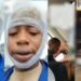 Skit-maker lands in hospital after being beaten to pulp by youths for ‘snake prank’ (Video)
