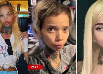 IG model who is HIV positive is blind again after undergoing eye surgery