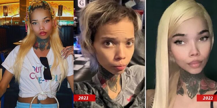 IG model who is HIV positive is blind again after undergoing eye surgery