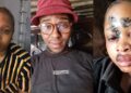 “He did this and got bail” – Lady calls out baby daddy who allegedly attacked her with bottle