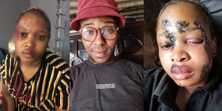 “He did this and got bail” – Lady calls out baby daddy who allegedly attacked her with bottle