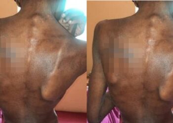 Police rescue a 17-year-old girl allegedly starved, beaten, and imprisoned in a goat pen by her aunt in Plateau.