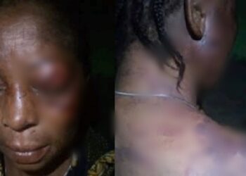 Woman allegedly battered by her husband over disagreement with his girlfriend in Rivers