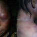 Woman allegedly battered by her husband over disagreement with his girlfriend in Rivers