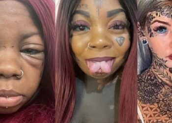 Mother goes blind after tattooing her eyeballs blue and purple to copy an influencer
