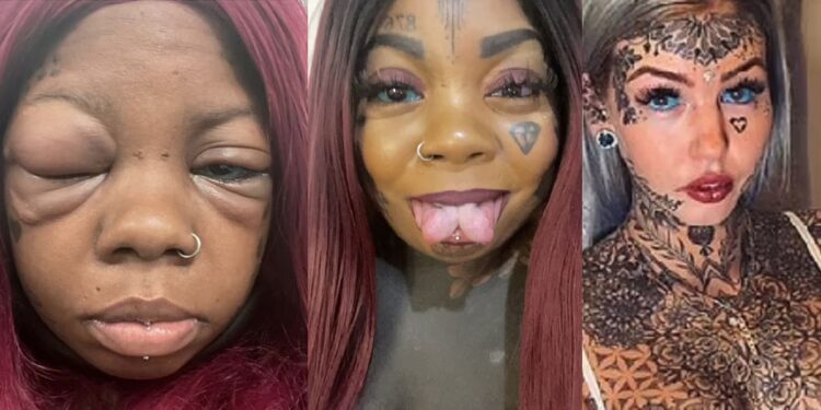 Mother goes blind after tattooing her eyeballs blue and purple to copy an influencer