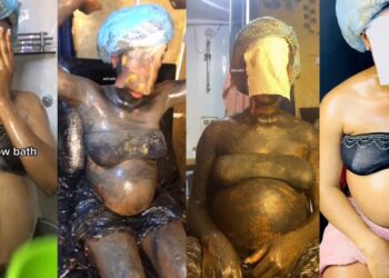 Pregnant woman causes