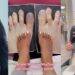 Pretty lady who didn’t like her long toes is mocked after getting toe-shortening surgery that looks worse (Video)