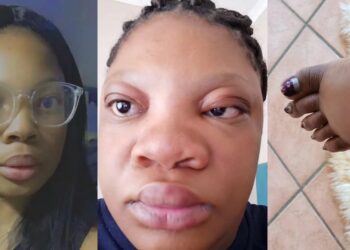 “Is she allergic to pregnancy?” – Lady’s pregnancy transformation sparks concern