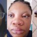 “Is she allergic to pregnancy?” – Lady’s pregnancy transformation sparks concern